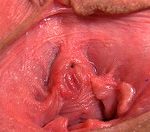 Redtube Gape My Pussy